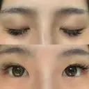 二重埋没 湘南美容歯科 大阪心斎橋院 BEFORE サムネイル用