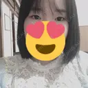 二重埋没 メディカルビューティセンター BEFORE サムネイル用