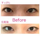 二重埋没 青山セレスクリニック 青山院 BEFORE サムネイル用