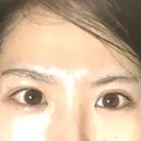 目頭切開 / 上まぶたたるみ取り 湘南美容クリニック 金沢院 BEFORE サムネイル用