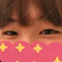 二重埋没 盛岡タウン形成外科クリニック BEFORE サムネイル用