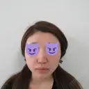 肌ヒアルロン酸注入（たるみ・シワ改善） / ボトックス（エラ・小顔） ジョウクリニック 姫路院 BEFORE サムネイル用