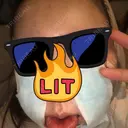 骨切り（あご） / 骨削り（エラ） / 脂肪注入（額） ボンディ美容整形外科（旧リオン整形外科） BEFORE サムネイル用