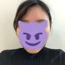 骨切り（あご） / 骨削り（エラ） ボンディ美容整形外科（旧リオン整形外科） BEFORE サムネイル用