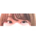 二重切開 神野美容形成外科クリニック BEFORE サムネイル用