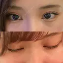 二重埋没 ビスポーククリニック 福岡院 BEFORE サムネイル用