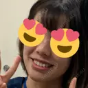 鼻尖形成（切開） / ヒアルロン酸注入（鼻） 東京ヒルズクリニック 新宿院 BEFORE サムネイル用