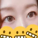 二重切開 こうべ花時計クリニック BEFORE サムネイル用