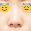 鼻尖縮小 / ヒアルロン酸注入（鼻） 東京ヒルズクリニック 新宿院 BEFORE サムネイル用