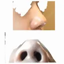 鼻尖縮小 東京ヒルズクリニック 新宿院 BEFORE サムネイル用