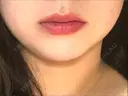 ボトックス（エラ・小顔） / 脂肪溶解注射（顔） / ヒアルロン酸注入（唇） / ボトックス（口角） id美容クリニック 銀座院 BEFORE サムネイル用