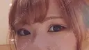 二重切開 / 目頭切開 / 眼瞼下垂（切開） / 目尻切開 / 上まぶたたるみ取り / ヒアルロン酸注入（涙袋） ジュエリー美容外科 BEFORE サムネイル用