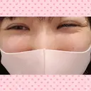 シワ取りボトックス 湘南美容クリニック 仙台院 BEFORE サムネイル用