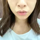 アートメイク（唇） BMC CLINIC 南青山 BEFORE サムネイル用