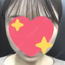 脂肪吸引（顔） / ボトックス（エラ・小顔） 銀座マイアミ美容外科 BEFORE サムネイル用