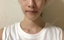 脂肪溶解注射（顔） 銀座フェイスクリニック（小顔整形・輪郭整形專門） BEFORE サムネイル用