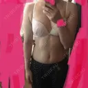 脂肪吸引（二の腕） 湘南美容クリニック 八王子院 BEFORE サムネイル用