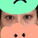 クマ治療 湘南美容クリニック 千葉センシティ院 BEFORE サムネイル用