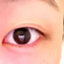 二重切開 / 目頭切開 / 眼瞼下垂（切開） / 鼻中隔延長（切開） / 小鼻縮小（切開） / タレ目形成・グラマラスライン（切開） / 軟骨移植 / 目尻靭帯移動 / 鼻尖縮小 / 口角挙上 / 鼻翼基部形成（貴族手術） 大阪TAクリニック BEFORE サムネイル用