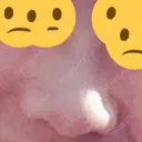 その他（鼻） 湘南美容クリニック 横須賀中央院 BEFORE サムネイル用