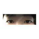 二重埋没 湘南美容クリニック 長野院 BEFORE サムネイル用