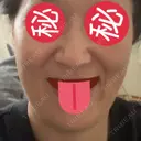 ボトックス（エラ・小顔） 湘南美容クリニック 藤沢院 BEFORE サムネイル用