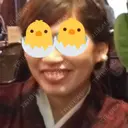 ガミースマイル手術 TCB東京中央美容外科 渋谷西口院 BEFORE サムネイル用