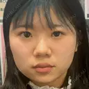 ボトックス（エラ・小顔） / 脂肪溶解注射（顔） 湘南美容クリニック 宇都宮院 BEFORE サムネイル用