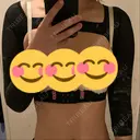 脂肪吸引（二の腕） 湘南美容クリニック 長野院 BEFORE サムネイル用
