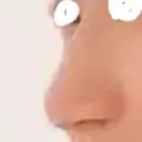 隆鼻術 アネシス美容クリニック BEFORE サムネイル用