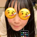 鼻尖形成（切開） / 鼻中隔延長（切開） / 軟骨移植 / その他（鼻） KAUNIS CLINIC（カウニスクリニック） BEFORE サムネイル用