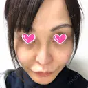 隆鼻術 / 鼻尖形成（切開） / 鼻中隔延長（切開） / 軟骨移植 / プロテーゼ除去 / 鼻修正 THE ROPPONGI CLINIC（ザ 六本木クリニック） BEFORE サムネイル用