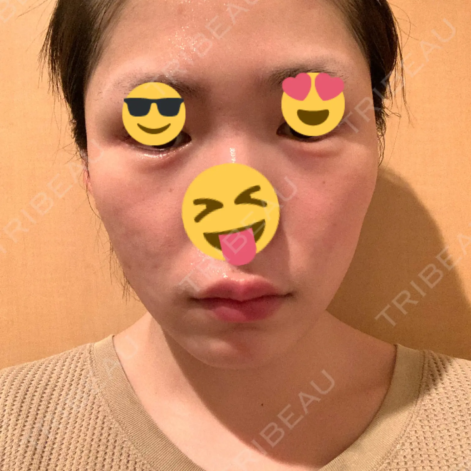 施術後の写真