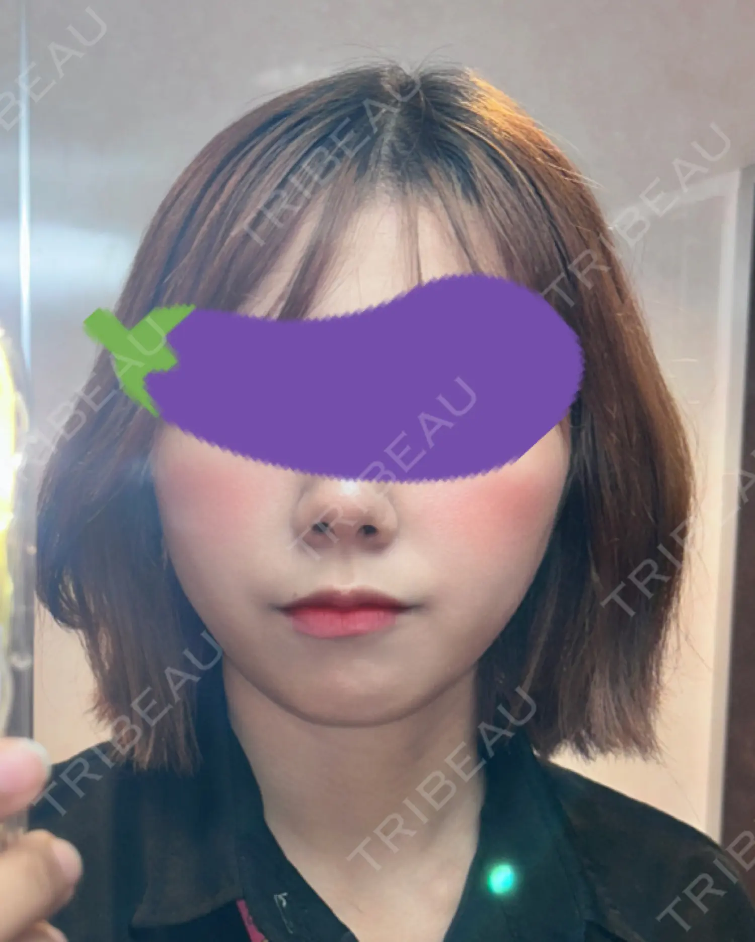 施術後の写真