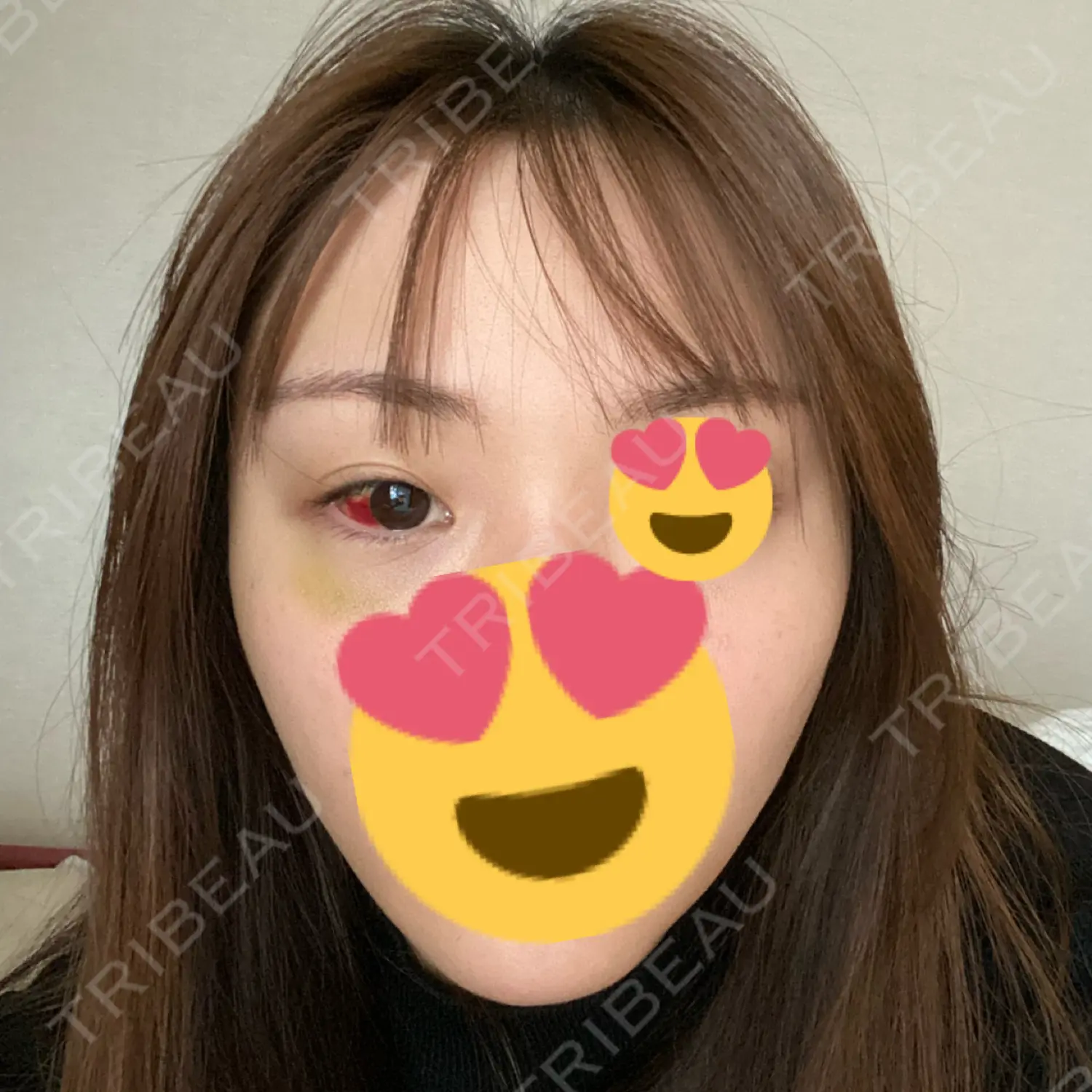施術後の写真