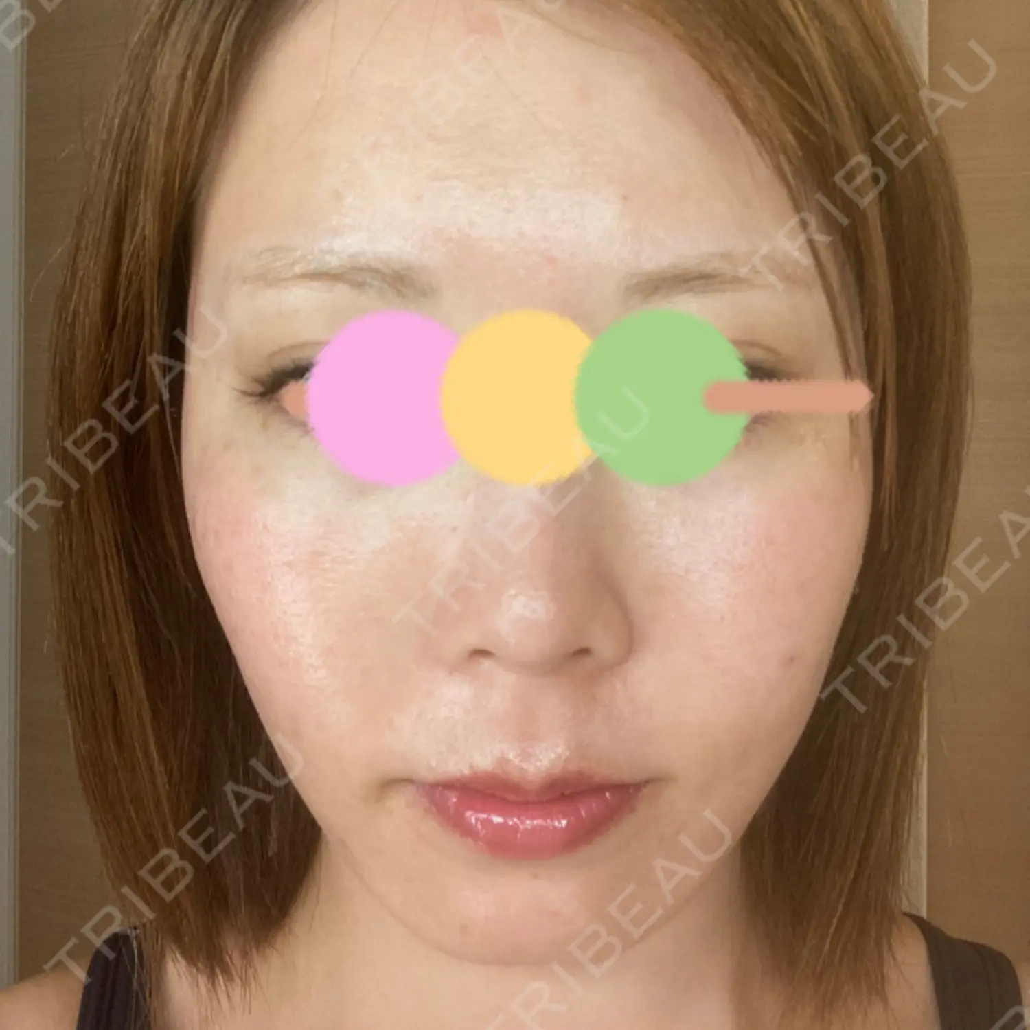施術後の写真