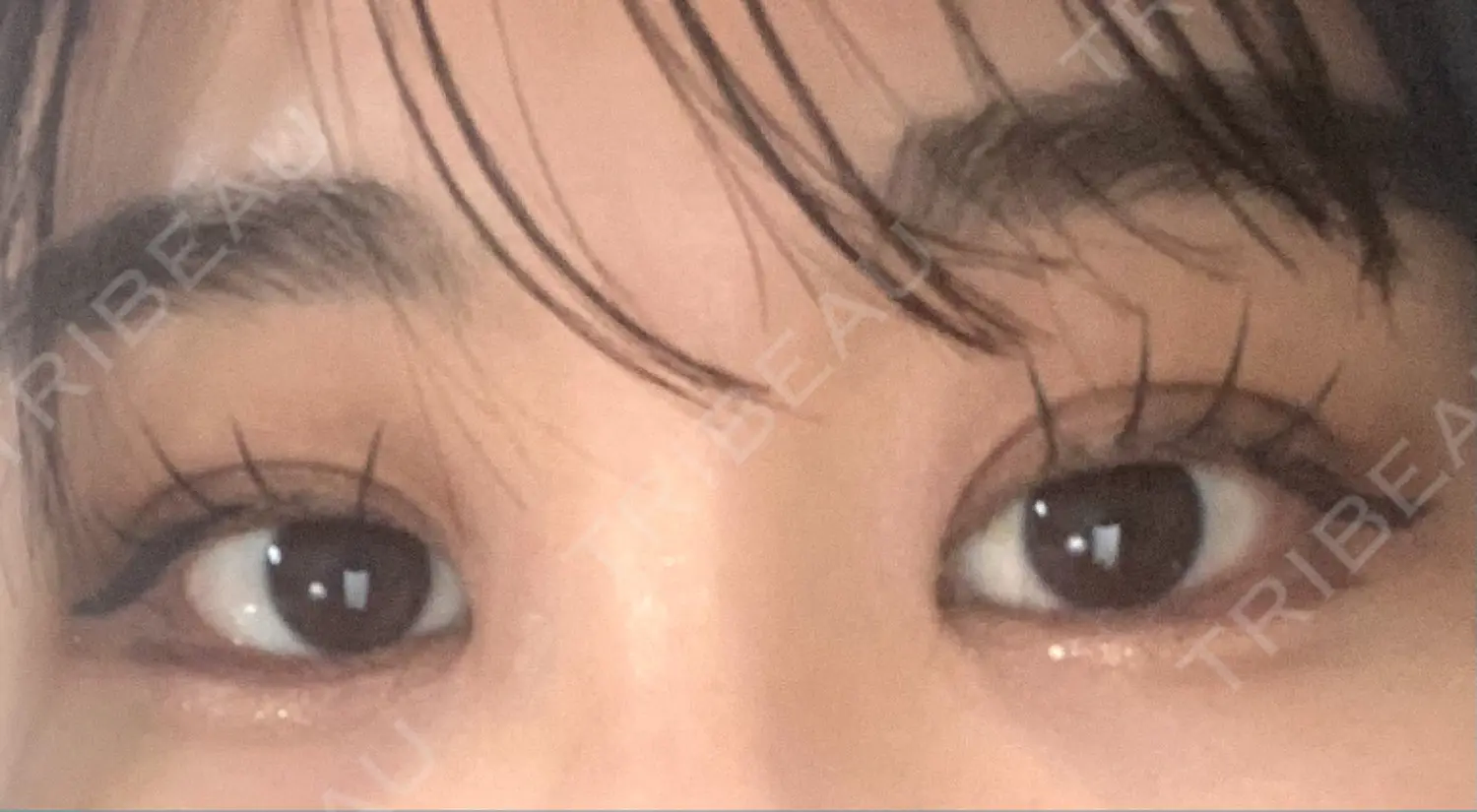 施術後の写真