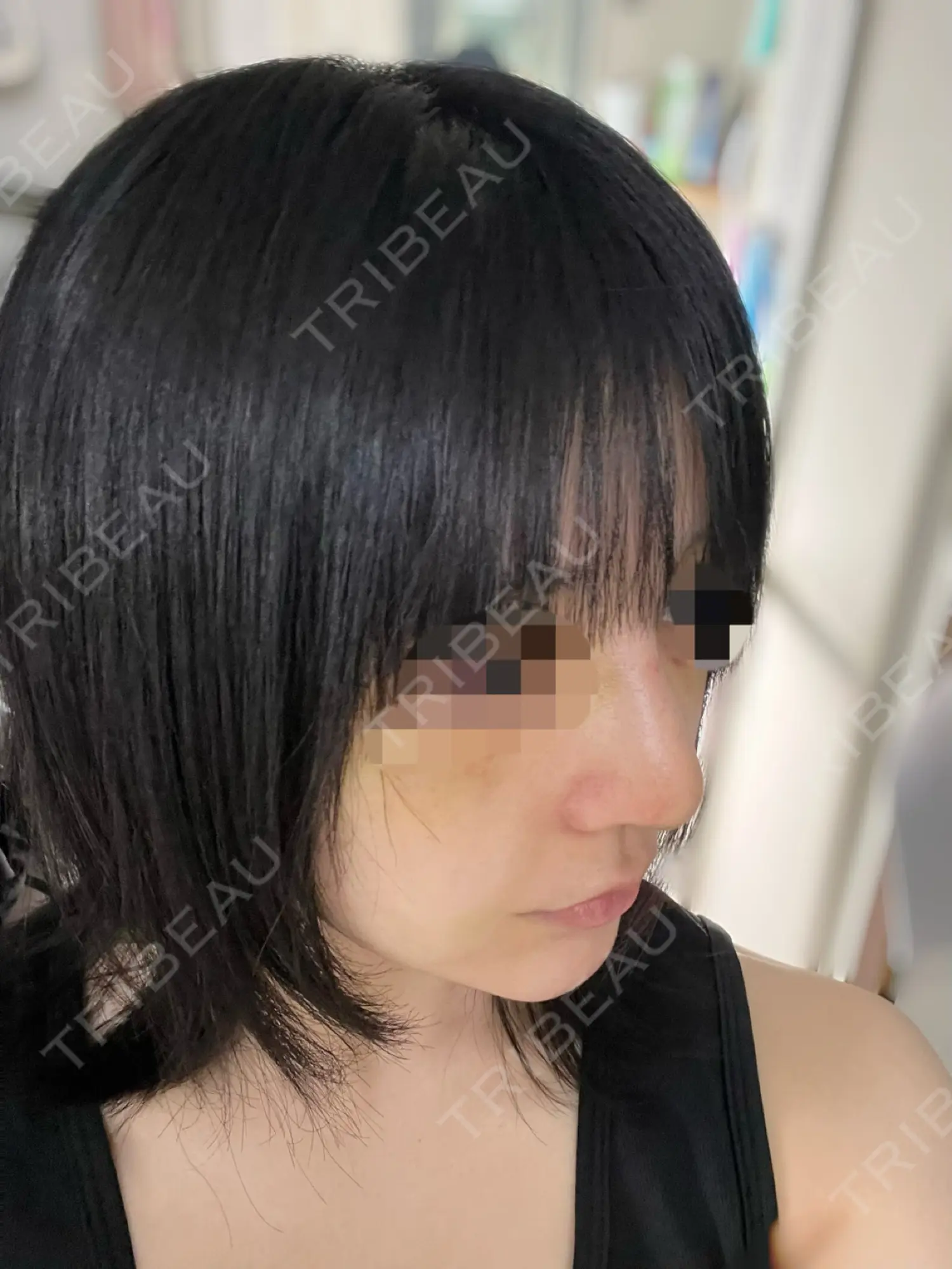 施術後の写真