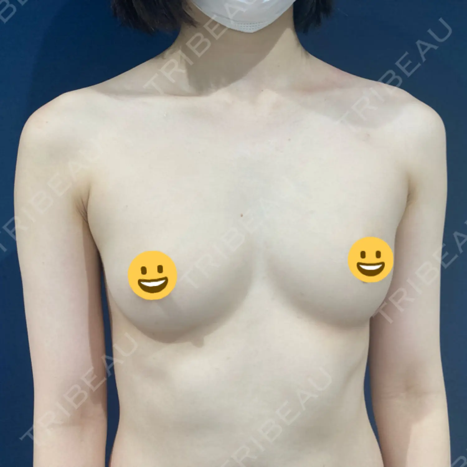 施術後の写真