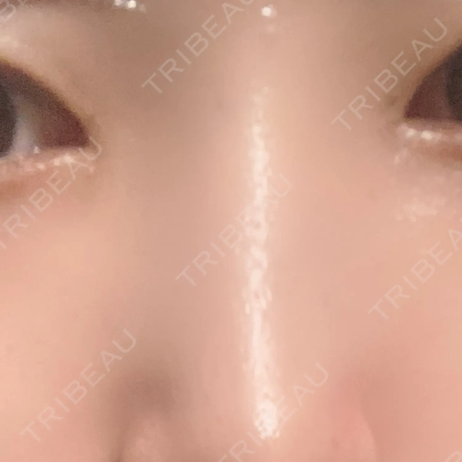 施術後の写真
