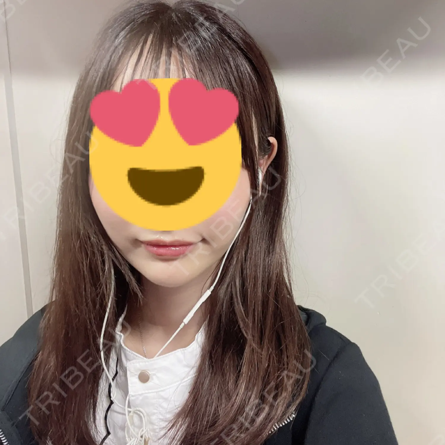 施術後の写真