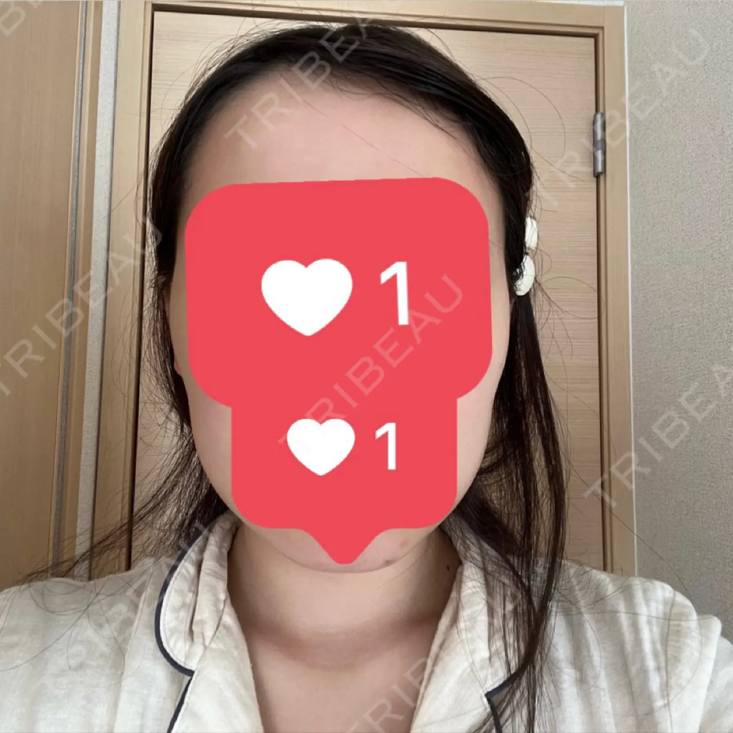 施術後の写真