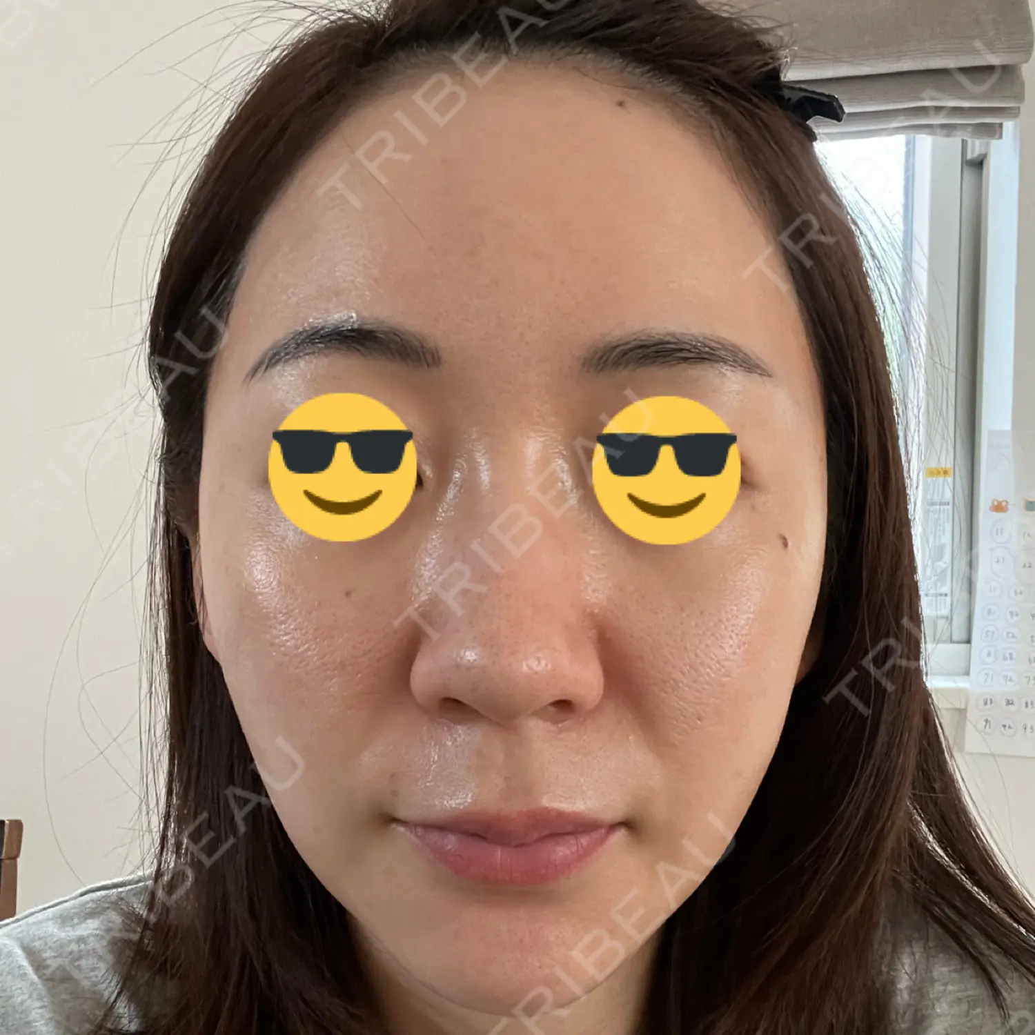 施術後の写真