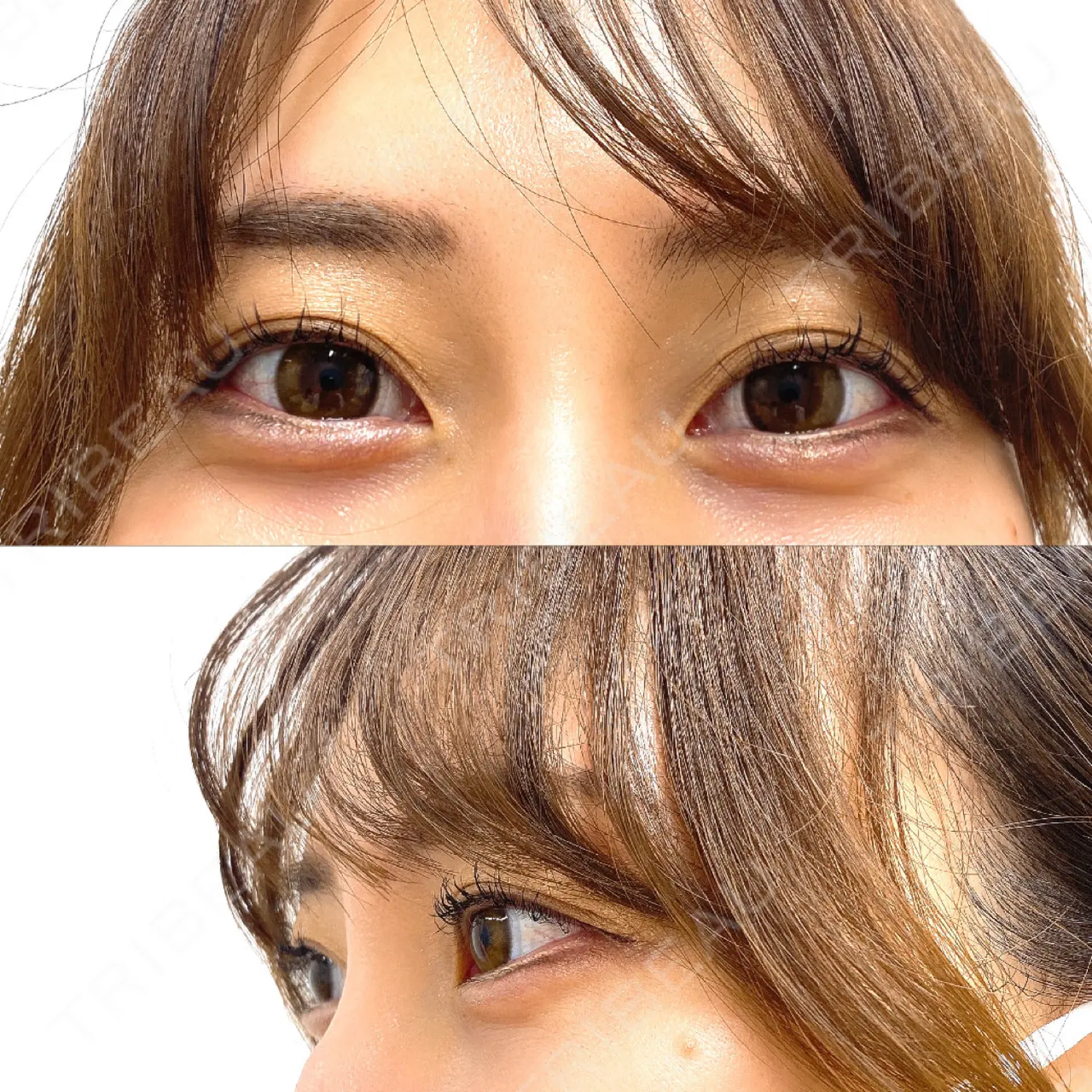 施術後の写真