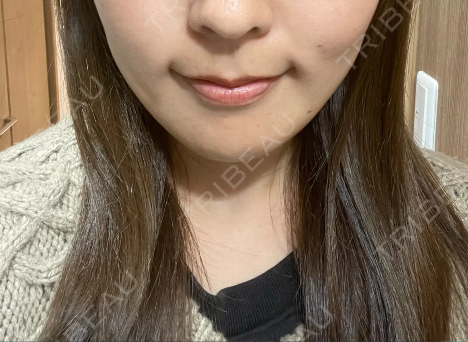 施術後の写真