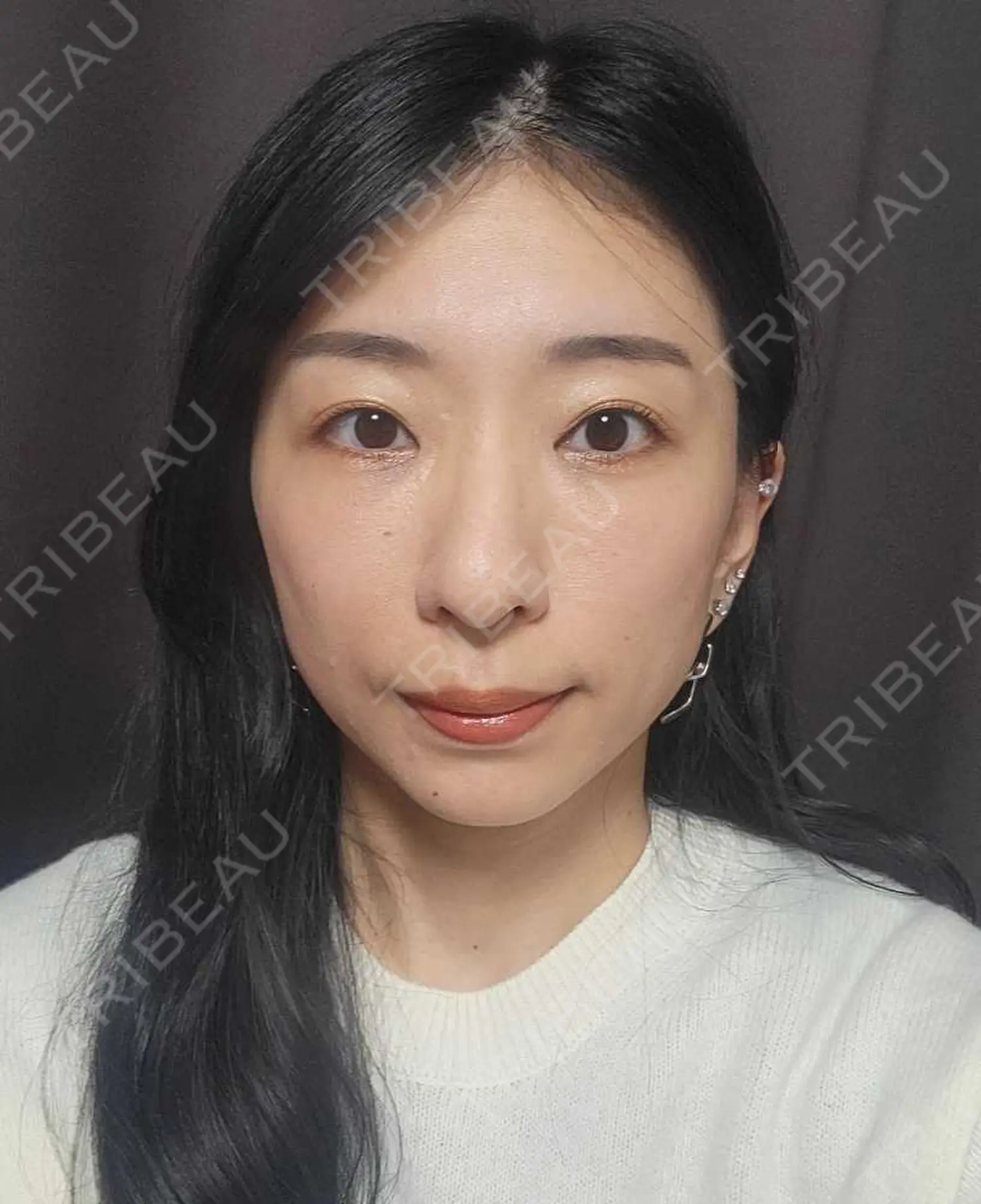 施術後の写真