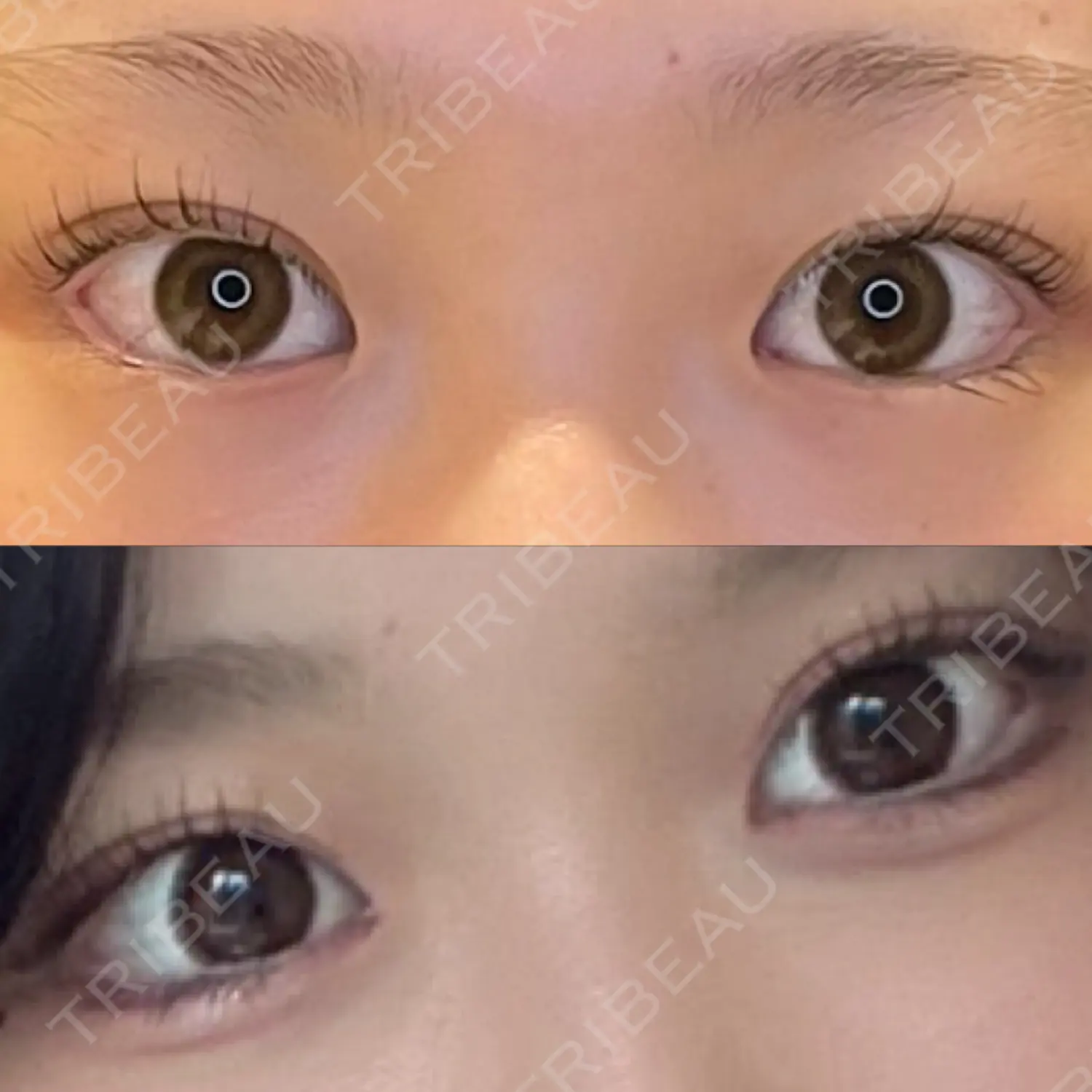 施術後の写真