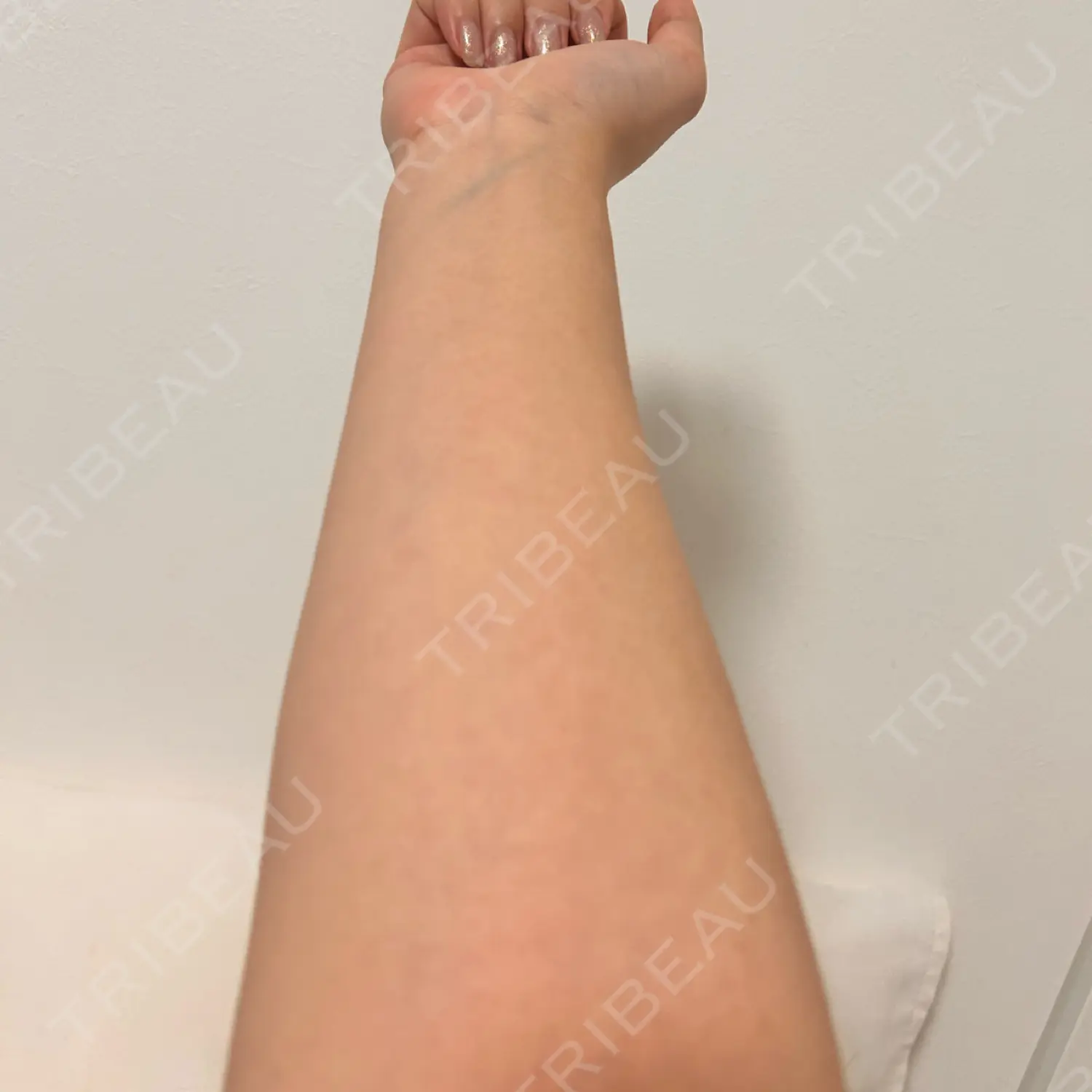 施術後の写真