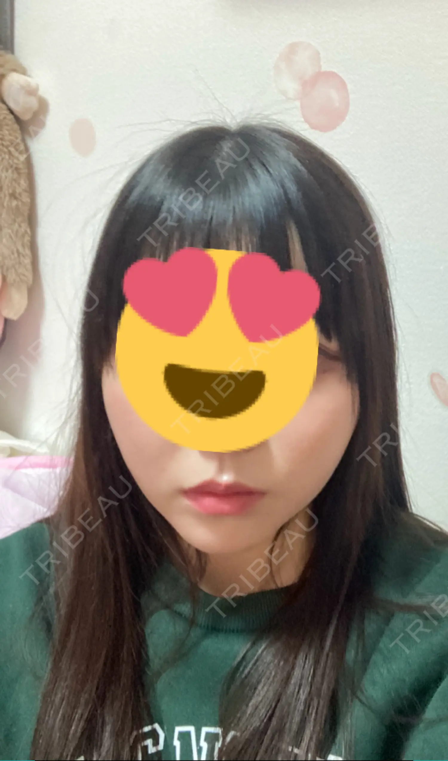 施術後の写真