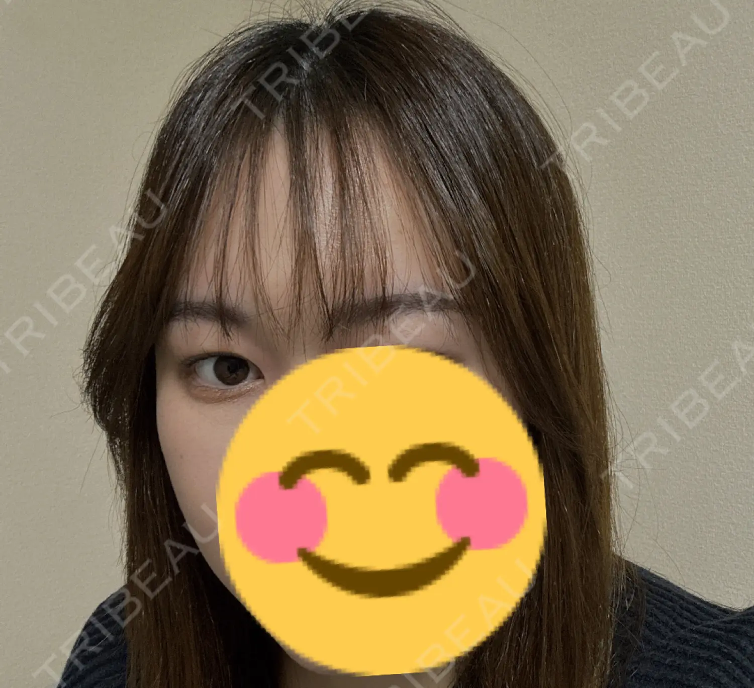 施術後の写真